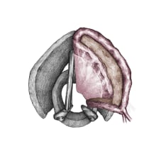 Cirugía de laringe - Ilustración científica. Un proyecto de Ilustración de Júlio Aliau - 13.07.2015