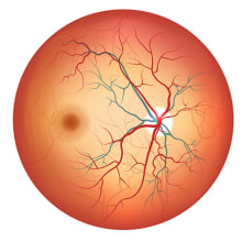 Modelo de red neuronal convolucional para la detección de retinopatía diabética en imágenes médicas.👩🏻‍⚕️👨🏻‍⚕️. Un proyecto de Programación, Desarrollo Web, Desarrollo de producto digital e Inteligencia Artificial de Richard Rosario Sánchez - 19.11.2023