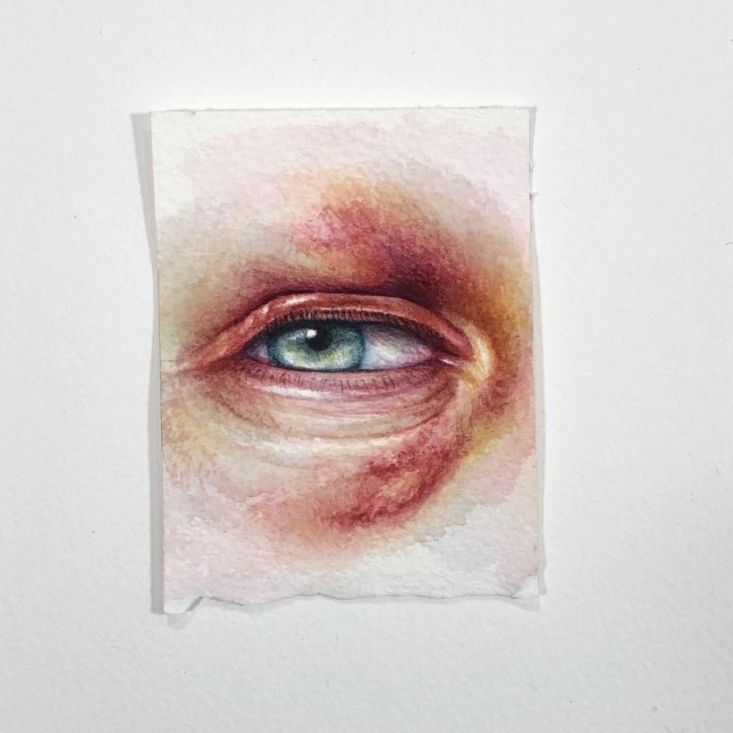 Bruised Eye Triptych 3