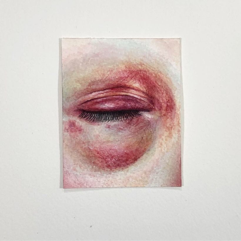 Bruised Eye Triptych 4