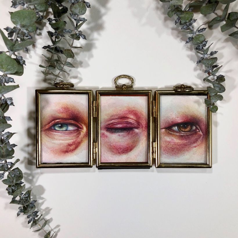 Bruised Eye Triptych 5