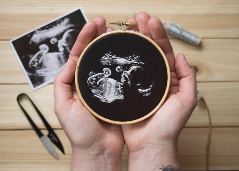 Ultrasound Embroidery  1