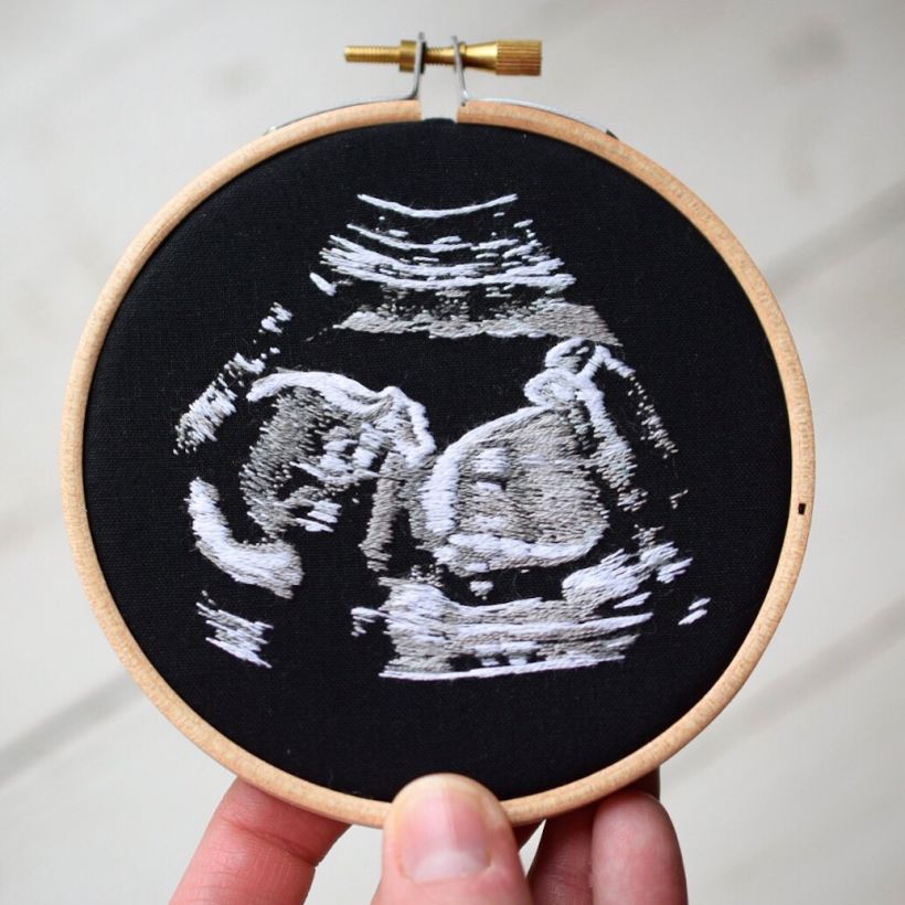 Ultrasound Embroidery  2