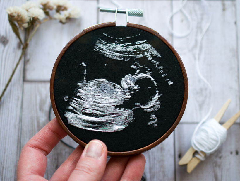 Ultrasound Embroidery  5