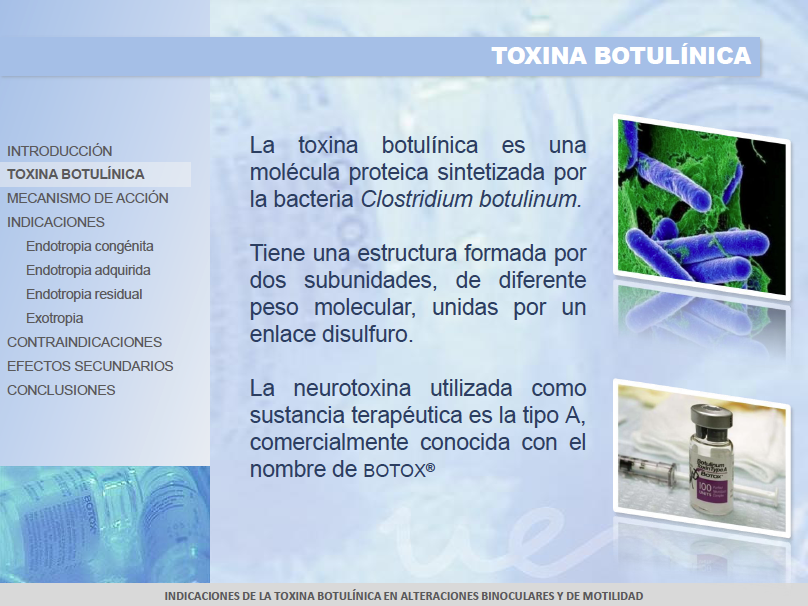 toxina botulínica 2