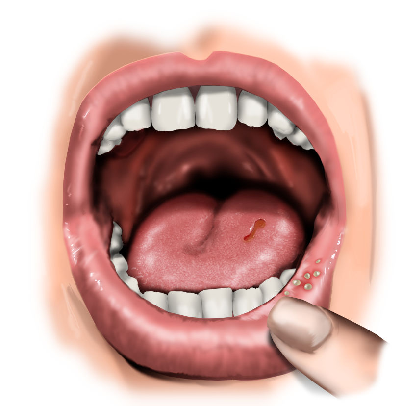 Ilustraciones odontologia 2