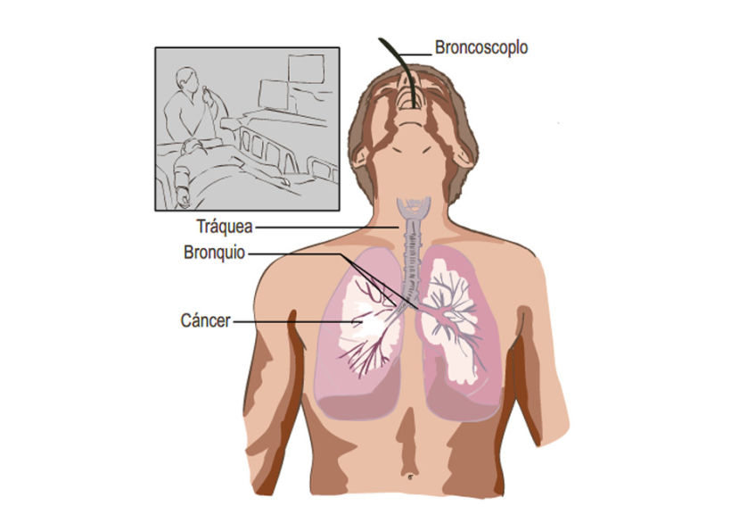 Ilustraciones casos clínicos 5