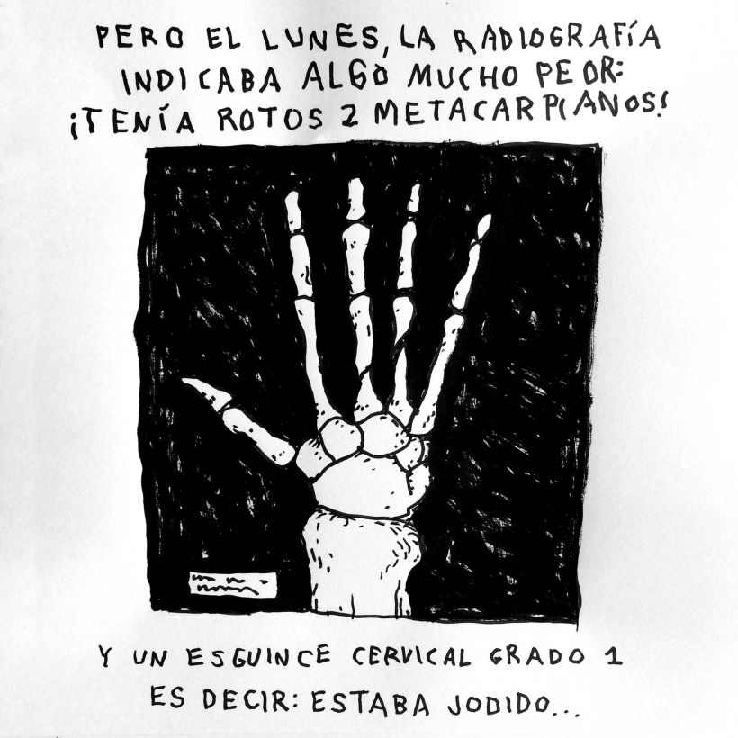 Diario ilustrado de mi mano derecha según la izquierda 5