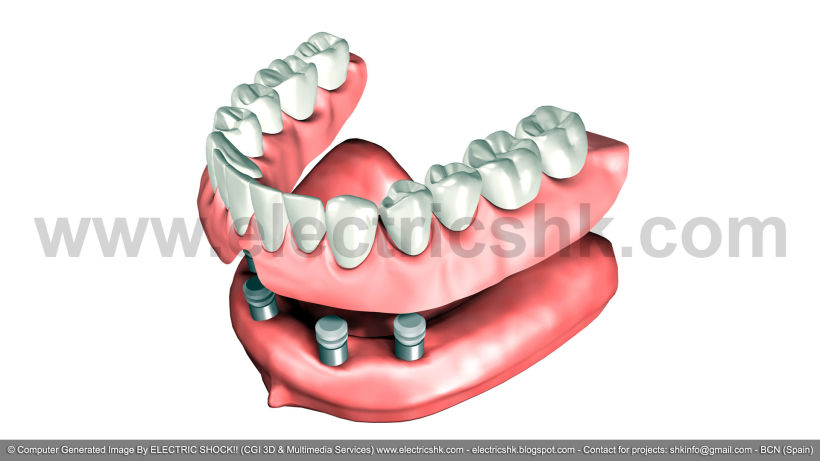 Productos dentales CGI 3D 2004 2
