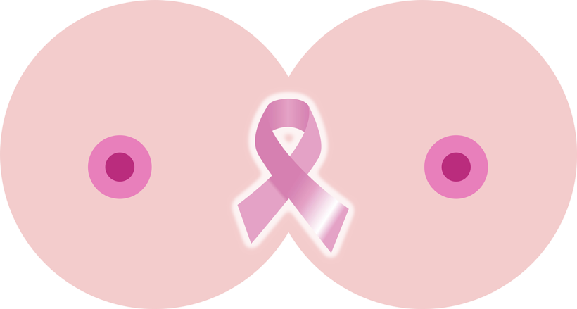 Folleto Cáncer de Mama / Brochure on breast cancer 1
