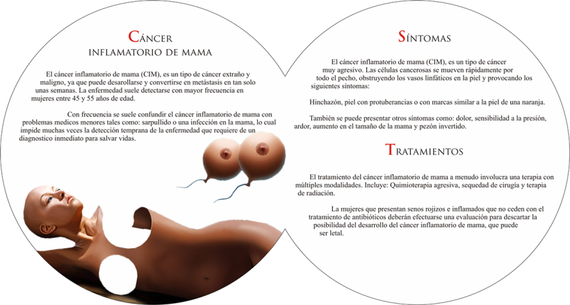 Folleto Cáncer de Mama / Brochure on breast cancer 2