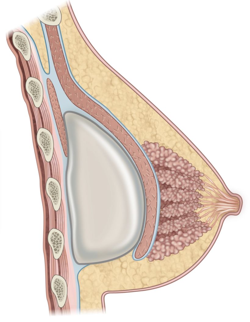 Ilustraciones anatómicas para cirugía 0