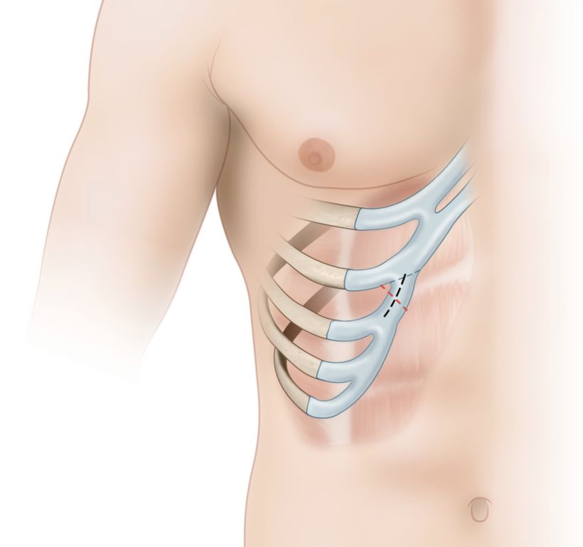 Ilustraciones anatómicas para cirugía 2