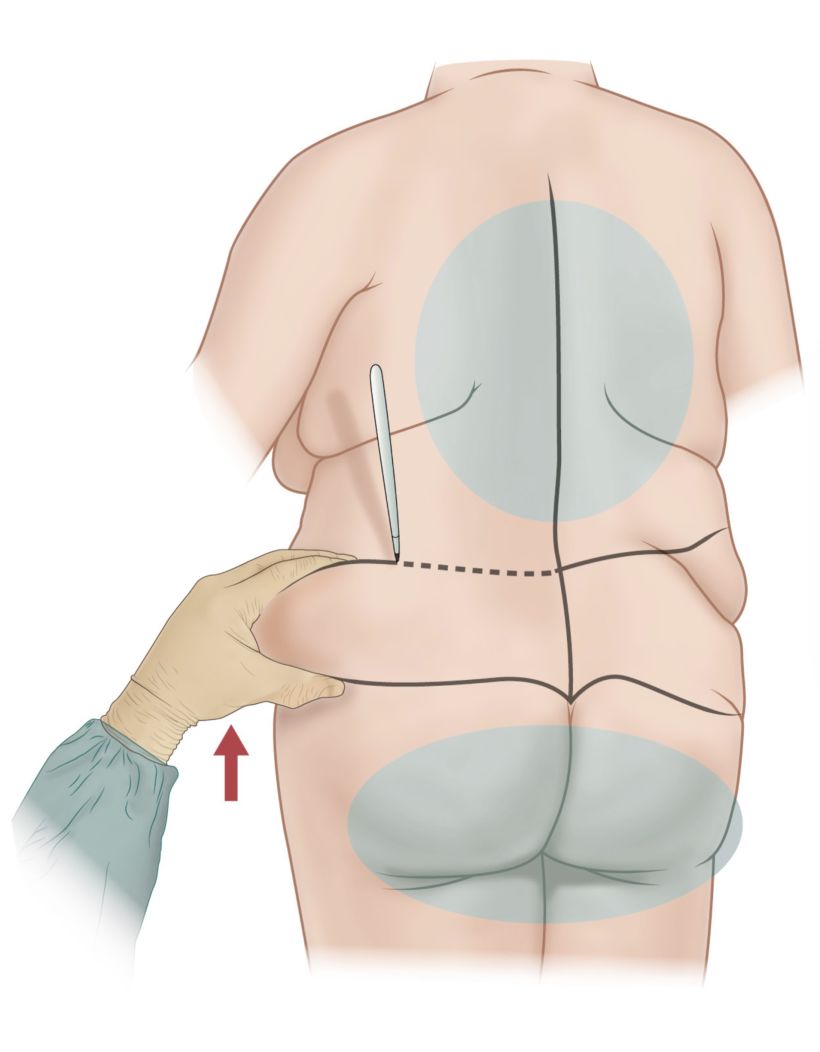 Ilustraciones anatómicas para cirugía 6
