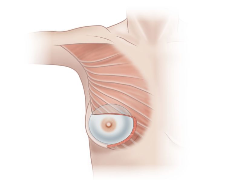 Ilustraciones anatómicas para cirugía 7